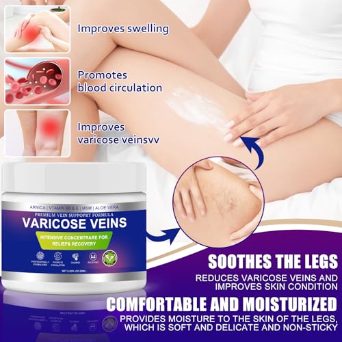 Varicose Veins Cream for Legs with Arnica & Aloe Vera