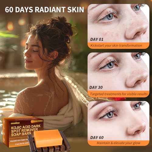 Kojic Acid Soap for Dark Spot Remover Bars with Turmeric, Vitamin C, Retinol, Collagen with Hyaluronic Acid, Vitamin E, Shea Butter, Castile Olive Oil - 3.52 OZ x 2 Bars