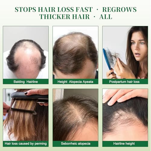 Batana Oil Hair Growth Shampoo for Thinning Hair Loss