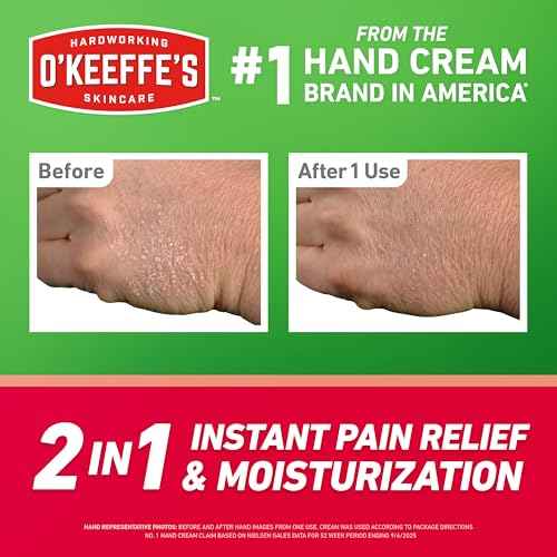 O'Keeffe's Working Hands Pain Relief Cream Skin Protectant with 4% Lidocaine and Cooling Peppermint Oil for Instant Relief from Pain, Itching, Irritation and Dryness, 3oz Tube