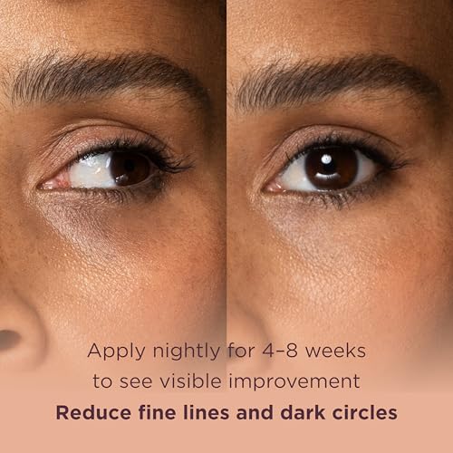 MATKAS Korean Retinol Under Eye Cream for Dark Circles & Puffiness 0.5 fl.oz. - Brightening Under Eyes Cream for Wrinkles & Anti Aging, Korean Under Eyes Brightener for Dark Circles, Retinol Eye Serum