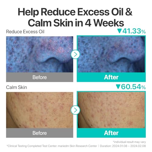Numbuzin No.1 Pantothenic B5 Soothing Cream – Sebum & Acne Control