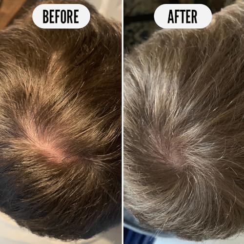 Noughty Get Set Grow Hair Tonic - Leave-In Treatment 2.5oz