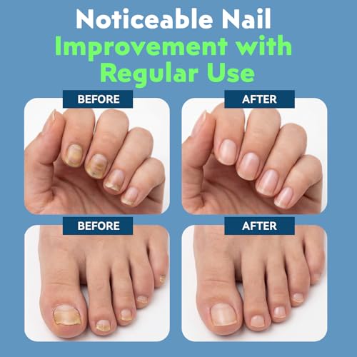 Nail Care Pen for Healthy-Looking Nails - 3ml, Twist Pen Applicator