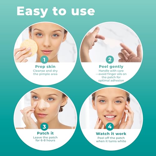 Pimple Patches for Nose (12 Pack), Cover Nose Pimples - Hydrocolloid Acne Patches - Pimple Patch Hydrocolloid Patches & Pimple Stickers, Nose Strip, Zit Patches