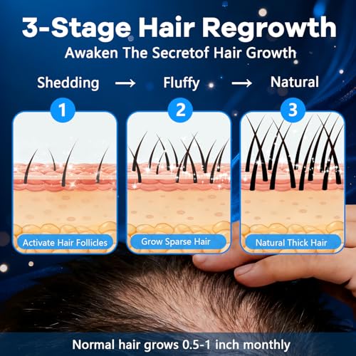 5% Minoxidil Foam for Men with Biotin - Hair Growth Treatment