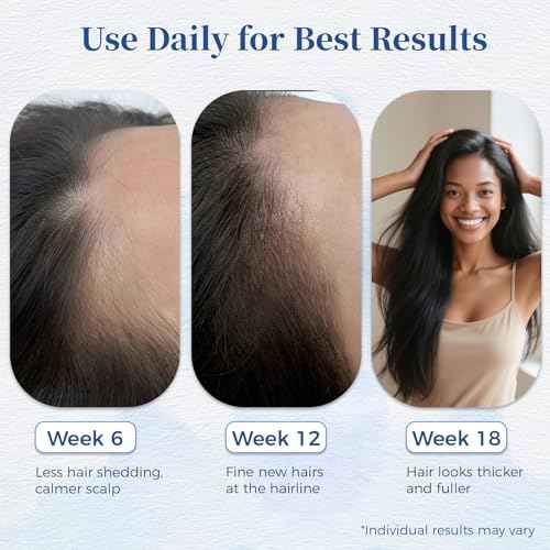 Hair Growth Serum Roll On 25ml with Saw Palmetto, Rosemary & Pea Extract£¬Helps Support Thicker, Fuller Hair Appearance£¬Clean, Non-Greasy Hair Loss Support for Men & Women Pack of 1