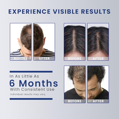 Oiameen Hair Growth Cap 650nm LLLT Red Light Therapy