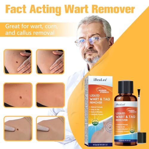 Wart Remover Liquid with 12% Salicylic Acid