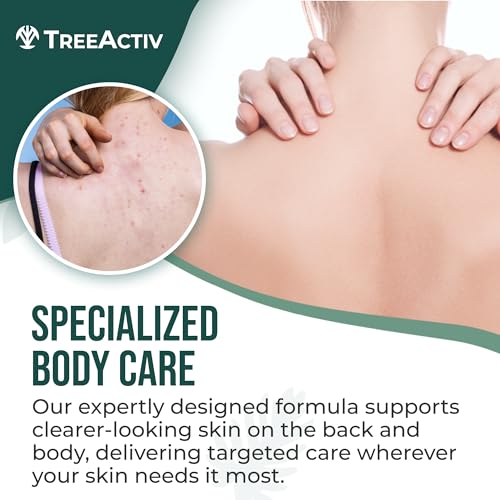 TreeActiv Body & Back Acne Spray, Original Formula, 8 fl oz, 2% Salicylic Acid, Helps Clear Cystic & Body Acne on Chest, Shoulders & More, For Teens & Adults