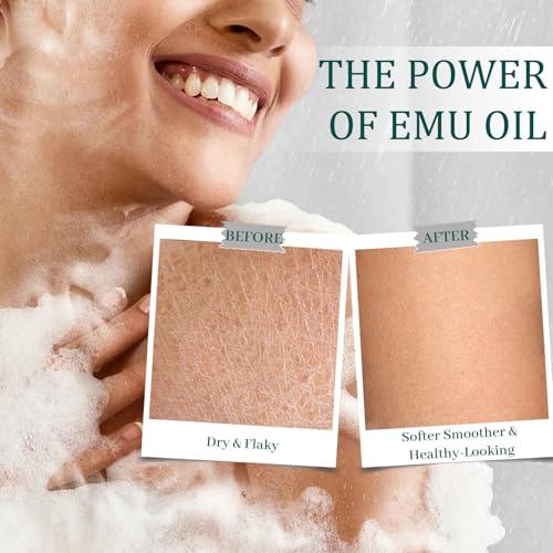 Emu Oil Soap Bars 3 Pack, Handmade Cold Processed Exfoliating Body Wash Bar, Moisturizing for Dry Sensitive Skin, Soothes with Omega-Rich Oils