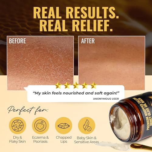 Beef Tallow and Honey Balm for Skin and Face Moisturizer Whipped with Olive Oil and Beef Tallow Lipbalm - 4oz