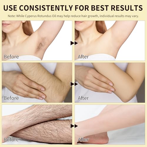 Cyperus Rotundus Oil for Hair Removal & Skin Care