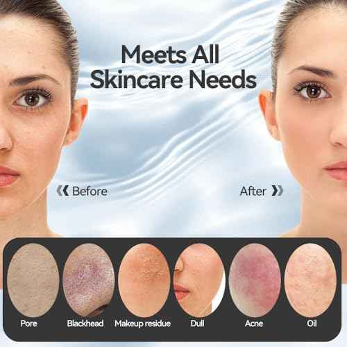 Facial Cleansing Brush, Silicone Face Scrubber with Heat and Vibration 5 Speeds, Waterproof Rechargeable Electric Face Scrub Brush for Men & Women, Deep Cleansing, Exfoliating and Massage (Purple)