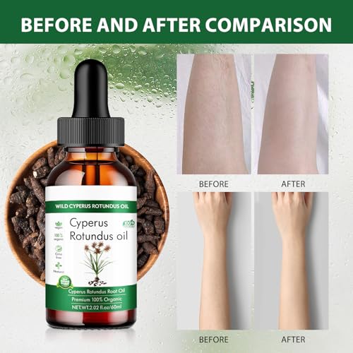 Cyperus Rotundus Oil for Hair Removal - 2.02 fl oz