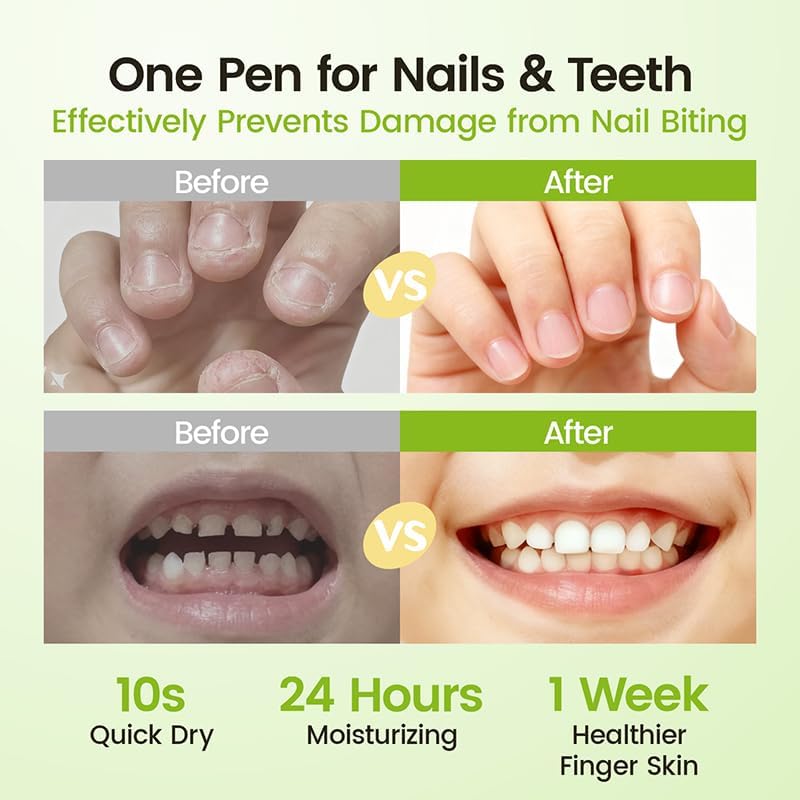 RUNBEN Kids Nail Biting Prevention Pen - Safe, Non-Toxic Treatment