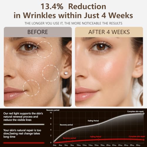 Viioaiio Black Wireless LED Light Therapy Face Mask with 4 Modes, 336 LEDs, 850nm NIR & Red Light, Rechargeable 2000mAh, for Home & Travel
