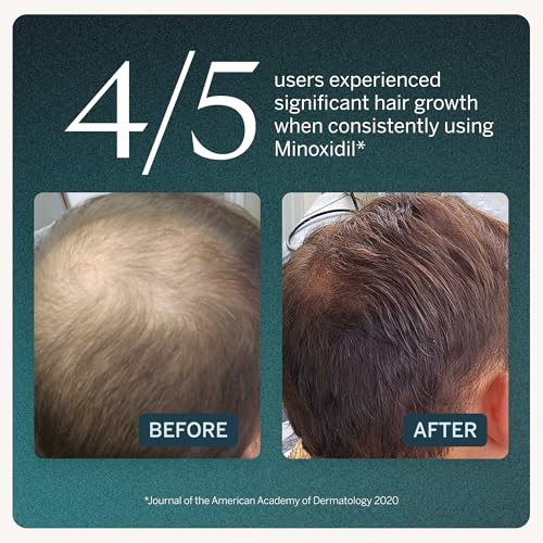 Minoxidil 5% Hair Growth Serum for Men - 3 Month Supply