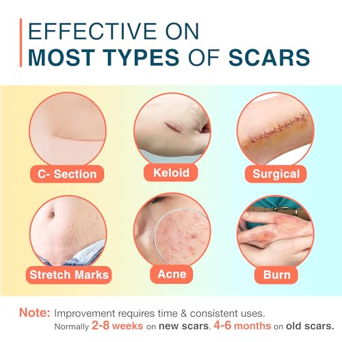 Silicone Scar Sheets, 1.55¡± x 156¡± - 4M, Medical Silicone Scar Tape Roll, Reusable Scar Strips for Surgical, C-Section, Keloid Bump, Stretch Marks, Acne, Hypertrophic Scar Treatment