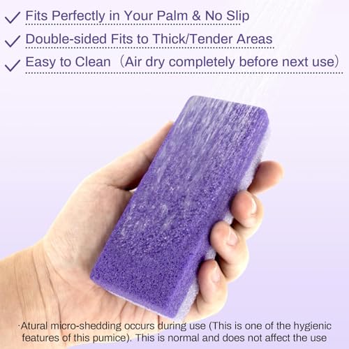 RAQEHO 10-Pack Dual-Sided Foot Pumice Stone for Callus & Hard Skin