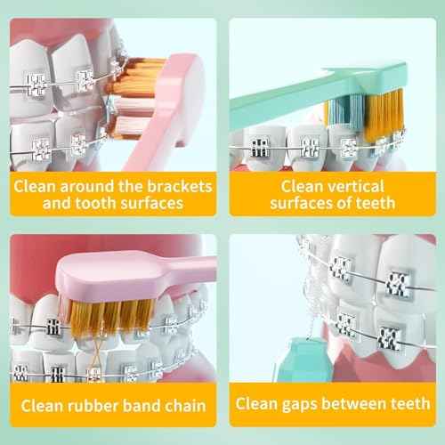 Y-Kelin 2IN1 Orthodontic Braces Toothbrush with interdental Brush