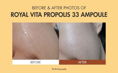 Dr.Ceuracle Royal Vita Propolis 33 Ampoule (30ml / 1.01 fl. oz.) - Ultimate Glow and Nourish Vitamin Serum for Radiant Skin, Formulated with Propolis and Royal Jelly Extract