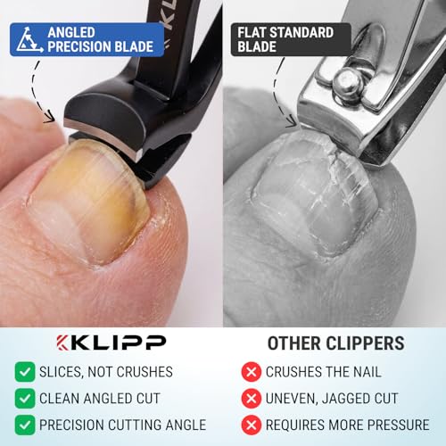Heavy Duty Toenail Clippers for Thick Nails - Ergonomic Long Handle with Curved Blades