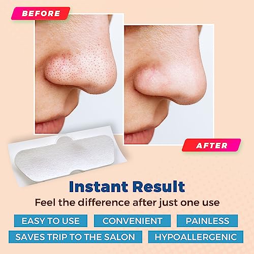MEDca Deep Cleansing Blackhead Pore Strips - Pack of 24 Peel - Off Blackhead Remover and Pore Unclogging Strips for Nose and Face, Chin, Forehead & Healthier Looking Skin