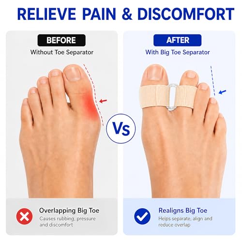 Ergonomic 2-Loop Big Toe Separator - Bunion Corrector & Cushioned Spacers