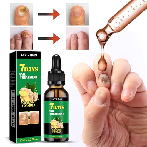 Ginger Cuticle Care Oil & Strengthening Nail Growth Serum - 2 Pack