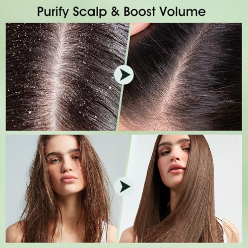 VOERUY Tea Tree Scalp Scrub with Mint Oil & Massager - 10.6oz