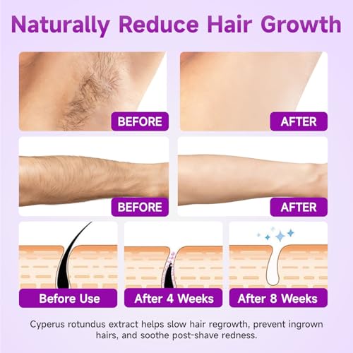 Cyperus Rotundus Oil Serum for Hair Removal & Regrowth Inhibition