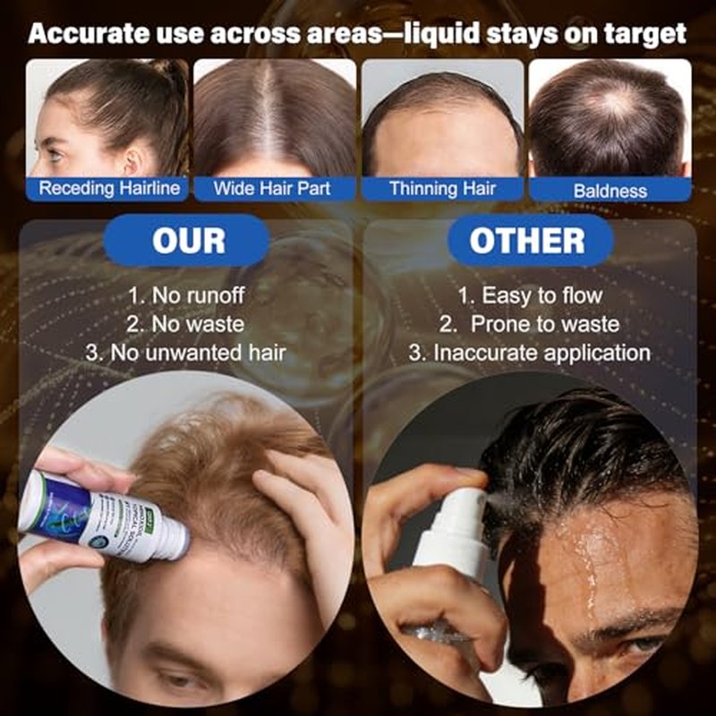5% Minoxidil Hair Growth Serum for Men & Women - 4-Month Supply