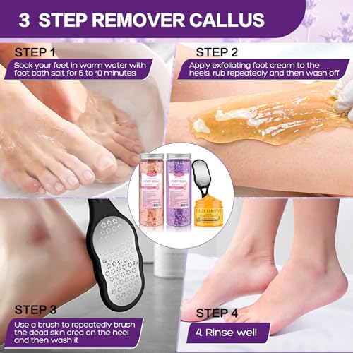 Himalayan Pink Foot Soak & Pedicure Kit - Callus Remover Set for Dry Feet