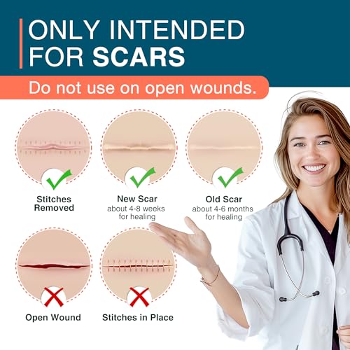 MEDLOT Silicone Scar Sheets, 1.5” x 156” Medical Silicone Scar Tape Roll, Reusable Scar Strips for Surgical, C-Section, Keloid Bump, Stretch Marks, Acne, Hypertrophic Scar Treatment