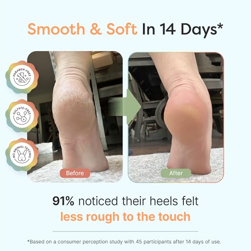 ZenToes Urea Foot Cream 40% - Exfoliating Lotion for Cracked Heels & Dry Feet