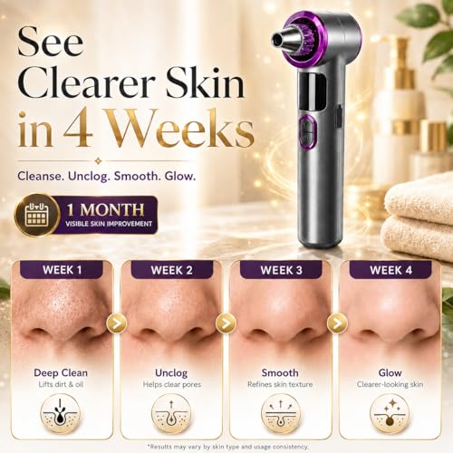 Heated Blackhead Remover Vacuum with Warm Compress & 3 Suction Levels