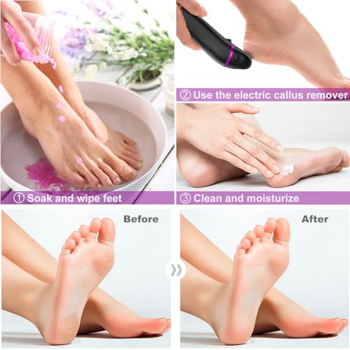 Electric Foot Callus Remover with 3 Roller Heads, 2-Speed Pedicure Tool
