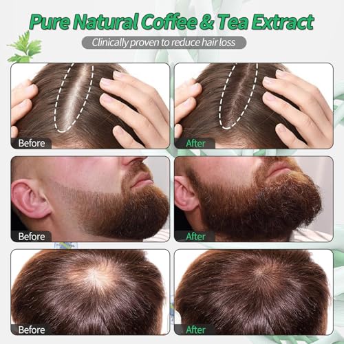 Hair Growth Serum Roll-On with Rosemary | 30ml for Thinning Hair