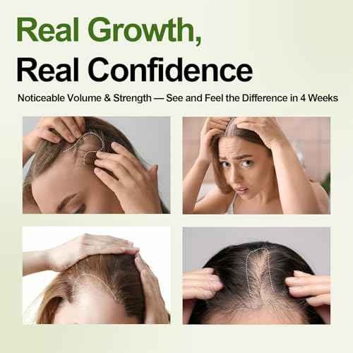 Hair Growth Oil Foam with Rosemary and Castor Oil Vegan Natural Formula for Thinning Hair Organic Plant Based Scalp Treatment Non Greasy Hair Regrowth Support for Men and Women 3 Bottles Each 2.11 oz