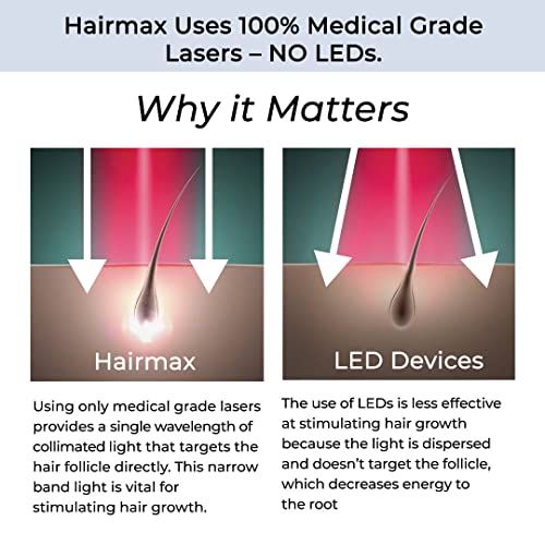 Hairmax LaserBand 82 - Medical-Grade Laser Hair Growth Device