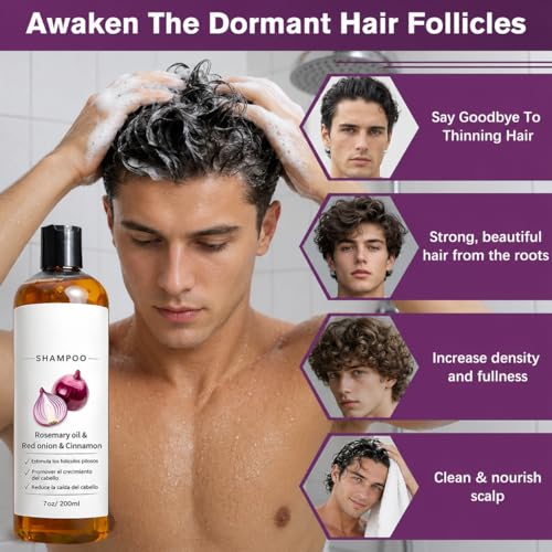 Onion Shampoo for Hair Loss & Growth - 200ml