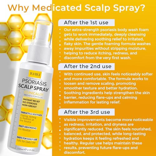 Psoriasis Scalp Spray for Fungal Infections & Itchy Relief