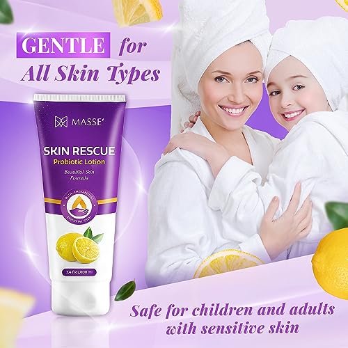 Massey's Skin Rescue Probiotics Lotion - Daily lotion for Men & Women - Refreshing Lemon Scent - Non-Greasy Moisture for Smooth & Sensitive Skin - 3.4 oz
