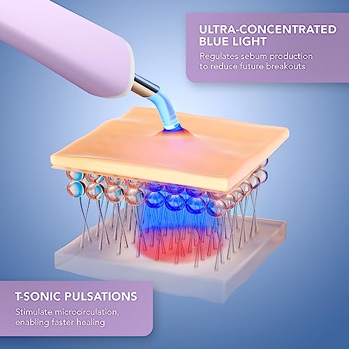 FOREO ESPADA 2 Plus LED Blemish Treatment Device