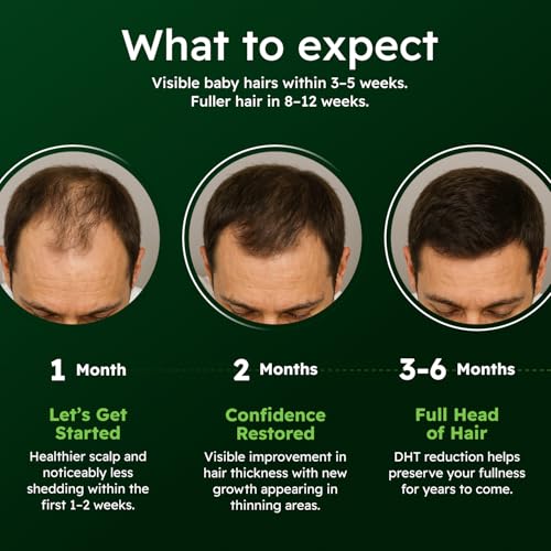 Alphainfuse Hair Serum for Men – Ginseng & Eclipta Formula