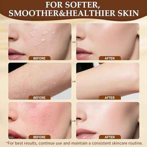 Beef Tallow for Skin, Tallow and Honey Balm for Face, Grass-Fed Beef Tallow & Raw Wild Honey, Deep Hydration & Nourishment, Oil-Free & Unscented, Fast Absorbing