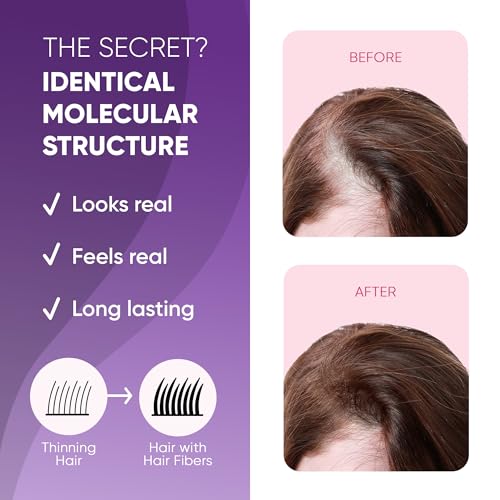 Hair Fibers for Thinning Hair & Bald Spots - Dark Brown 25g