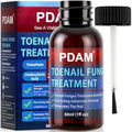 Toenail Fungus Treatment - 25% Undecylenic Acid Maximum Strength