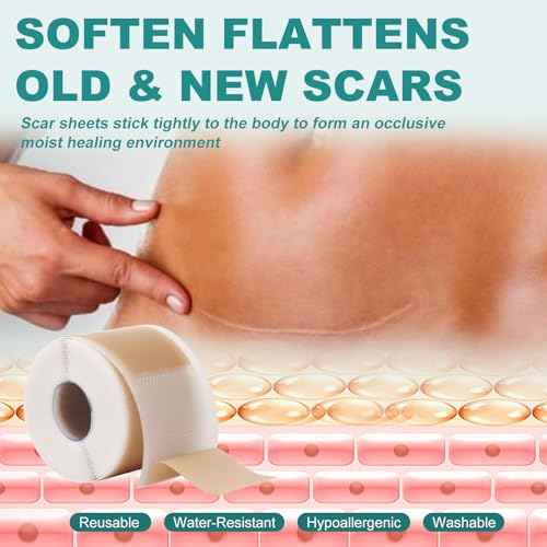 Silicone Scar Sheets, Silicone Scar Tape(1.6"x 158"), Scar Tape for Scar Removal Treatment, Reusable Silicone Scar Strips for Surgical, C-Section, Keloid, Burn, Acne, Surgical Scars